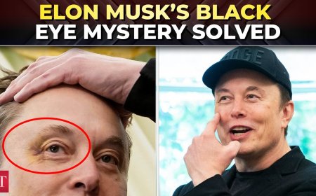 Elon Musk’s Black Eye: A Glimpse into a Controversial Farewell