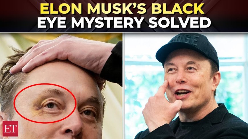Elon Musk’s Black Eye: A Glimpse into a Controversial Farewell