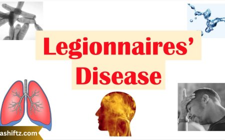 Legionnaires’ Disease: Causes, Symptoms, Treatment, and Prevention